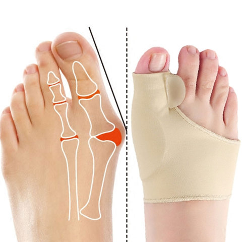 2Pcs=1Pair Toe Corrector Orthotics Feet Foot Care Bone Thumb Adjuster Correction Soft Pedicure Socks Bunion Straightener ► Photo 1/6