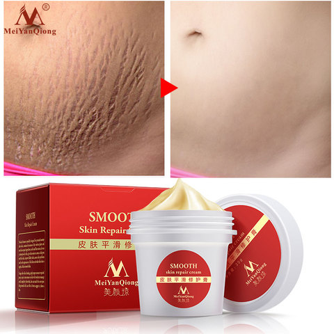 Smooth Skin Stretch Mark Skin Cream Removes Maternal Skin Repair Body Cream Removes Postpartum Scar Care Gentle Moisturizing ► Photo 1/6