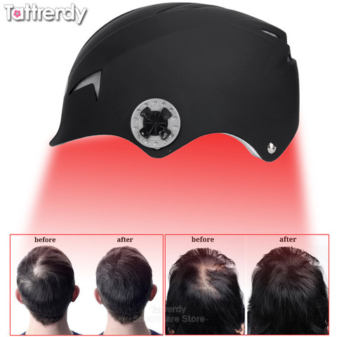 Hair Growth Cap Upgrade Hair Regrow Laser Helmet Fast Growth Hairs Cap Hair Loss Solution For Men Women Diodes Treatment Hat ► Photo 1/1
