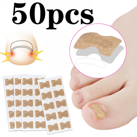 50 stickers  Ingrown Toenail Paronychia Treatment Toe nail repair Nail Correction Stickers ► Photo 1/5