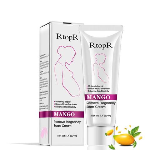 RtopR 40ml Mango Stretch Mark Pregnancy Scar Remover Repair Anti-Aging Anti-Winkles Skin Firming Treatment Maternity Cream TSLM1 ► Photo 1/6