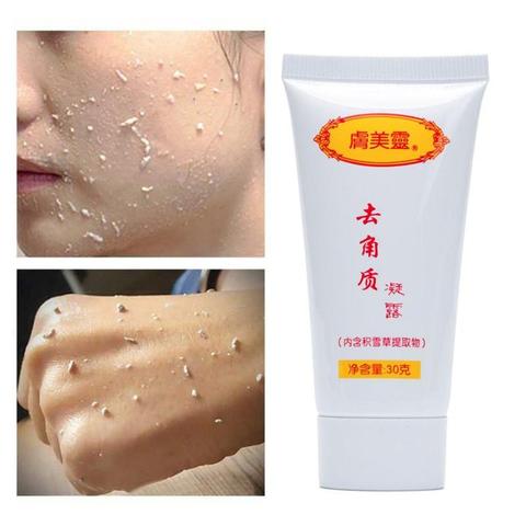 Facial Scrub Ginger Exfoliating Gel Hyaluronic Acid Facial Cleanser Nourishing Cleanser Moisturizing Face Wash Anti-spot Gel ► Photo 1/6