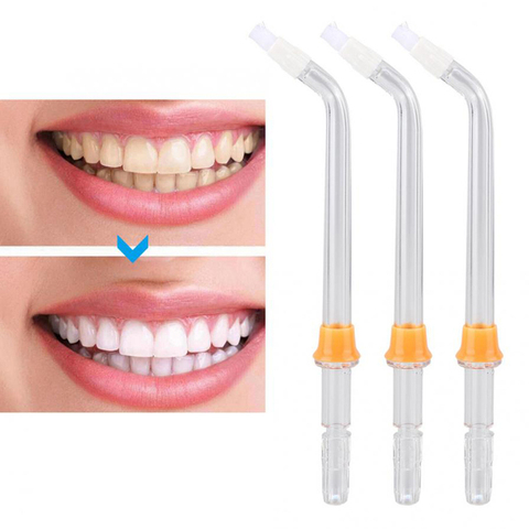 3 Pieces Replacement Orthodontic Tip Jet Nozzle Fit For Waterpik Oral Irrigator Water Flosser Denture And Dental Braces Cleaning ► Photo 1/6