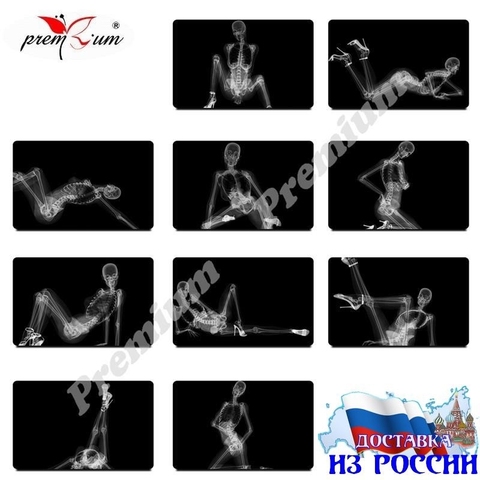 Fridge magnet stiker Erotic photos through X-ray Fridge magnet 54x86 mm. ► Photo 1/3