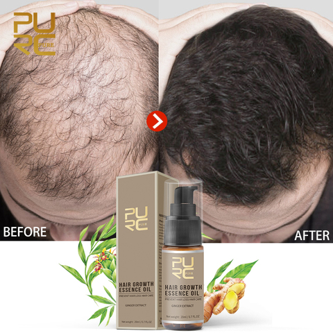 PURC Hot sale Fast Hair Growth Essence Oil Hair Loss Treatment Help for hair Growth Hair Care 20ml ► Photo 1/6