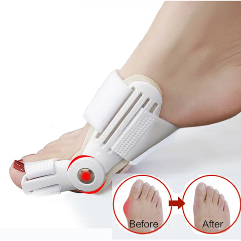 1Pcs Hallux Valgus Splint Correction Separator Finger Bicyclic Bunion Thumb Orthopedic Bone Big Toe Pedicure Foot Care Tool ► Photo 1/6