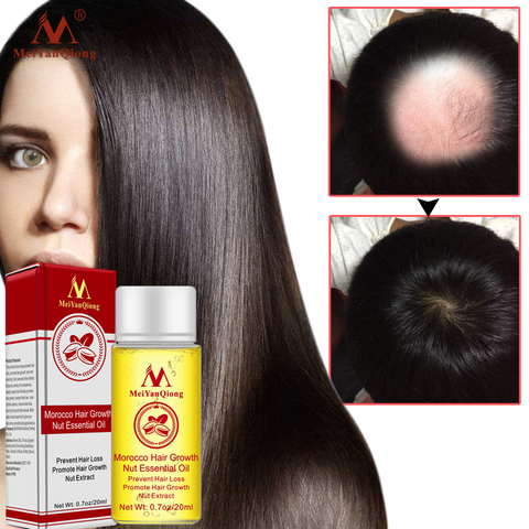 Powerful Hair Growth Oil Prevent Hair Loss Products Essence Liquid Treatment For Men And Women Repair Shampoo Hair Care 20ml ► Photo 1/6