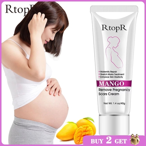 Mango Remove Pregnancy Scars Acne Cream Stretch Marks Treatment Maternity Repair Anti-Aging Anti-Winkles Firming Body Creams ► Photo 1/6