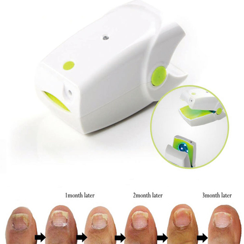 Highly Effective Rechargeable Nail Fungus Laser Treatment Device Nail Infection Onychomycosis Cure Nail Fungal Infections ► Photo 1/6