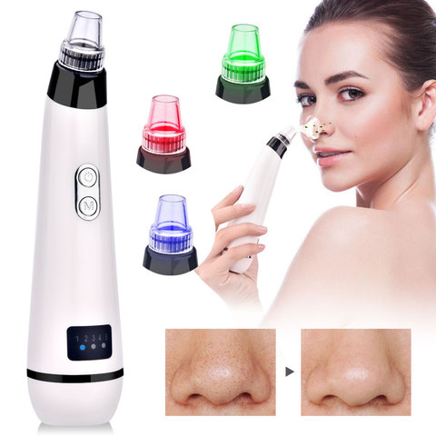 Blackhead Remover Face Nose T Zone Clean Pore Acne Pimple Removal Vacuum Suction Facial Clease ► Photo 1/6