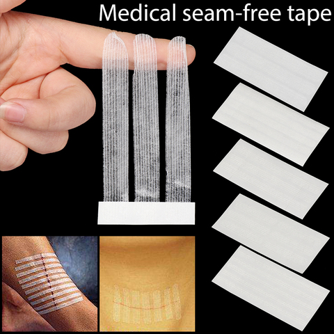 1 Set 5 Sizes Seam-free Sticker Skin Wound Strip Beauty Tape Safety Survival Tool Camping Emergency Outrdoor Accessories ► Photo 1/6