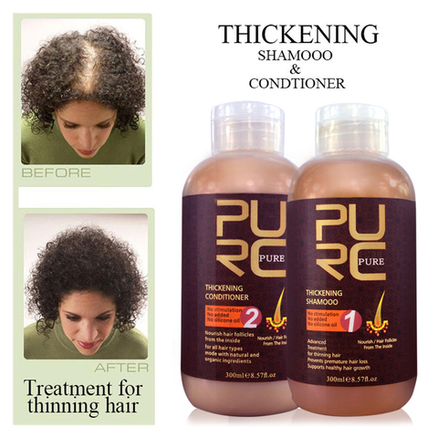 600ml Anti Hair Fall Fast Hair Growth Product Hair Thickening Shampoo & Hair Conditioner Free Shipping Anti Hair Loss Treatment ► Photo 1/6