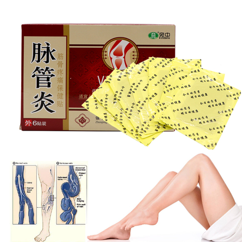 24pcs Varicose Veins Sticker Chinese Herbal Medicine Plaster Treatment Spider Varicosity Angiitis Removal Phlebitis Legs Veins ► Photo 1/6