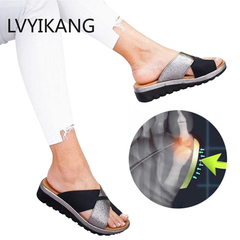 Women Shoes Slippers Orthopedic Bunion Corrector Comfy Platform  Ladies Casual Big Toe Correction Sandal ► Photo 1/6