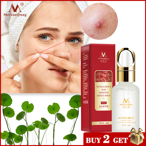 Centella Asiatica Acne Removing Essence face Serum liquid Moisturizing Anti Wrinkle Shrink Pore Control Oil Whiten Skin 10ml ► Photo 1/6