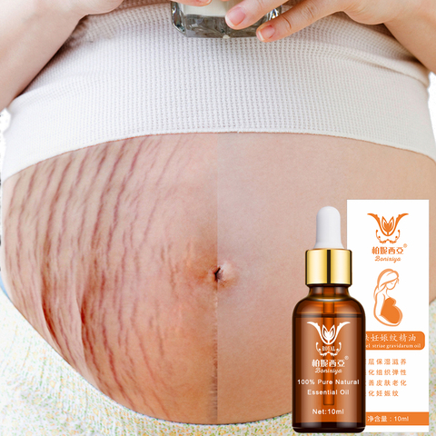 Stretch Marks Remover Essential Oil Eliminate Pregnancy Scars Maternity Repair Anti Winkle Skin Firming Treatment ► Photo 1/6