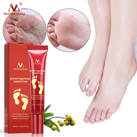 Foot Care Cream Foot spa Pedicure Herbal Detox Anti Fungal Infection Onychomycosis Fungus Treatment For legs ► Photo 1/6