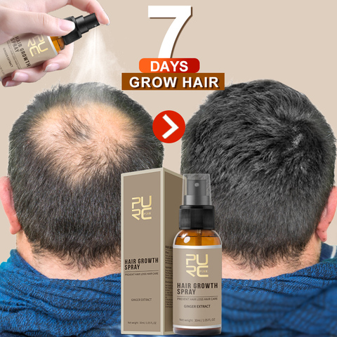 PURC New Hair Growth Spray Fast Grow Hair hair lossTreatment Preventing Hair Loss 30ml ► Photo 1/6