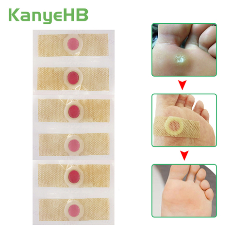 12pcs Medical Plaster Foot Corn Removal Calluses Plantar Warts Thorn Ointment Plaster Foot Care Pain Relief Pads Patches A172 ► Photo 1/6