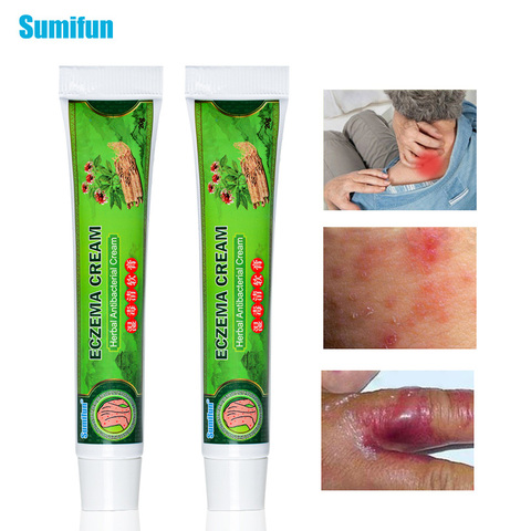 Sumifun Eczema Cream Skin Psoriasis Antipruritic Ointment Dermatitis Eczematoid Inhibit Bacteria Itch Item Care P1083 ► Photo 1/6