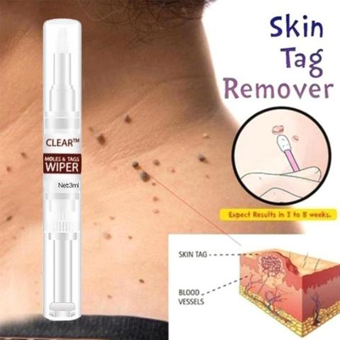 Clear Moles & Tag Wiper Wipe Off Tags & Moles Remover Organic Liquid Mole Freckle Spot Painless Removal 3ml ► Photo 1/6