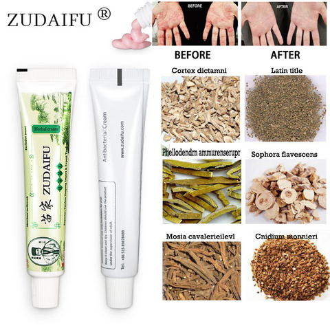 100% Original zudaifu Skin Psoriasis Cream Dermatitis Eczematoid Eczema Ointment Treatment Psoriasis Cream Skin Care Cream ► Photo 1/6