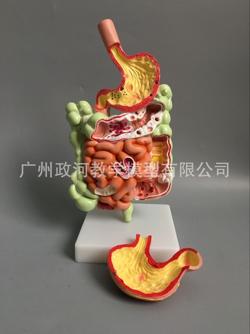 Human Digestive System Model Stomach Anatomy Large Intestine Cecum Rectum Duodenum Human Visceral Structure Biology Model ► Photo 1/6