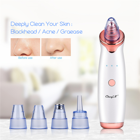 Blackhead Remover Skin Care Pore Vacuum Acne Pimple Removal Vacuum Suction Tool Facial Diamond Dermabrasion Machine Face Clean46 ► Photo 1/6