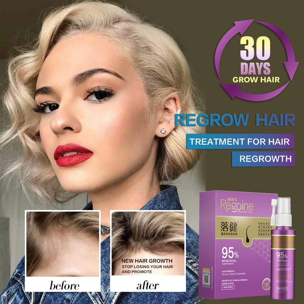 Buy Online Hair Growth Essence Oil Spray Fast Hair Growth Natural Anti Hair Loss Treatment Hair Solution Hair Care Products Hair Tonic Alitools