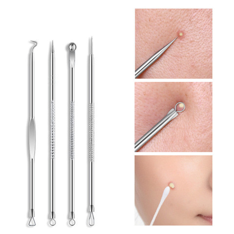 Acne Stainless Steel Removal  Pimple Remover Tool Blackhead Remover Black Head Extractor Face Skin Care Tools ► Photo 1/6