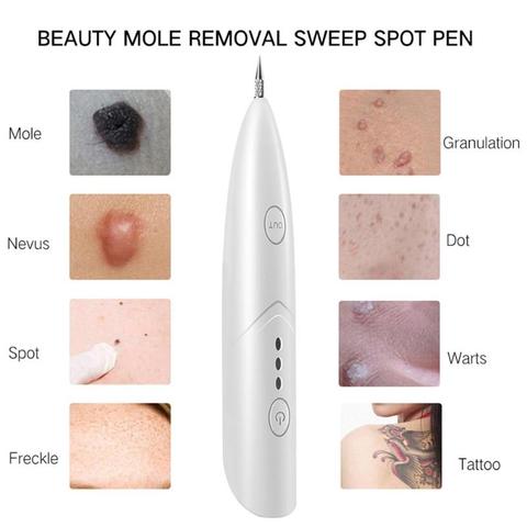 Sweep Spot Plasma Pen Beauty Mole Removal LCD Skin Care Point Pen Wart Tag  Tattoo Removal Tool Beauty Machine Laser Mole Removal Pen - China Plasma Pen  and Laser Mole Removal Pen