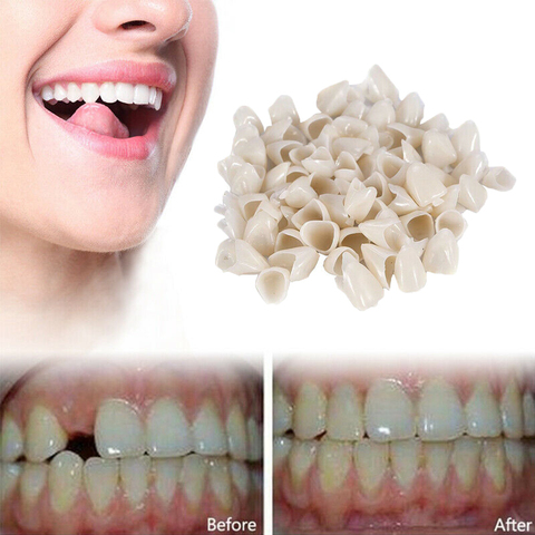 Temporary Crowns Posteriors Anterior Molar Front/Back Resin Tooth Teeth Caps Dental false teeth Cover removable teeth veneers ► Photo 1/6
