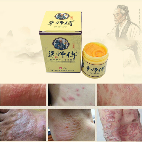 1pc Skin Psoriasis Cream Dermatitis Eczematoid Eczema Ointment Treatment Psoriasis Cream Skin Care Cream 10g ► Photo 1/6