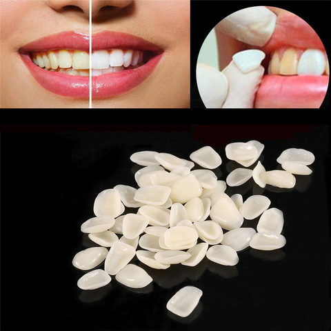 70pcs/bag Dental Ultra-Thin Resin Teeth Veneers Anterior A1 A2 Dental Temporary Crown Teeth Dentist Materials Dental Tools ► Photo 1/6