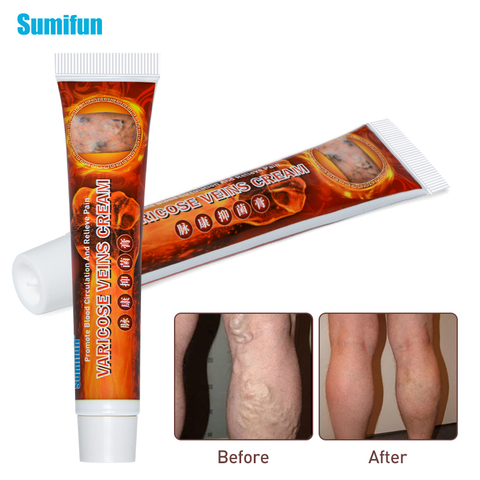 Sumifun 2022 New Varicose Veins Treatment Cream 100% Original Vasculitis Phlebitis Spider Pain Relief Ointment Medical Plaster ► Photo 1/6