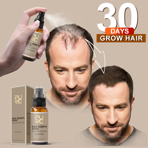 30ml/20ml Anti Hair Loss Hair Growth Spray Hair Care Essential Oil Liquid For Men Hair lossTreatment  for Groomed Growth TSLM1 ► Photo 1/6