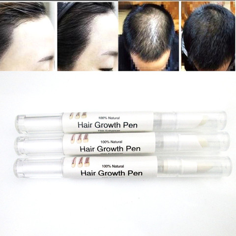 natural faster Grow 5% mino Hair Growth regrowth oil tonic serum products rajout cheveux cure Products Stop Hair Loss treatment ► Photo 1/6