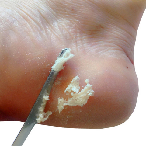 Shaver Manicure Pedicure Tools Dead Skin Remover Feet Pedicure