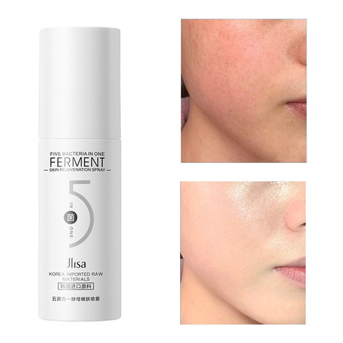 Yeast Toner Spray 100ML Moisturizing Refreshing Whitening Brightening Anti Dry Repair Face Skin Care Tonic Remove Ance Womens P ► Photo 1/6