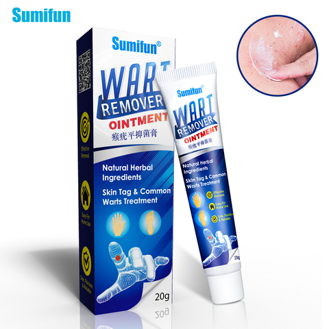 Sumifun-Crema para tratamiento de verrugas corporal, crema para cuidado del pie, eliminador de marcas en la piel, pomada de verrugas Plantar ► Foto 1/6