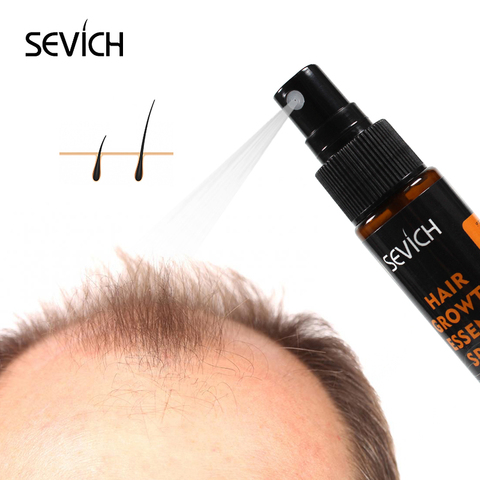 Sevich-espray para el crecimiento del cabello, producto para la pérdida de cabello, tratamiento antipérdida de cabello, Pelo fino espesa, 30ml ► Foto 1/6