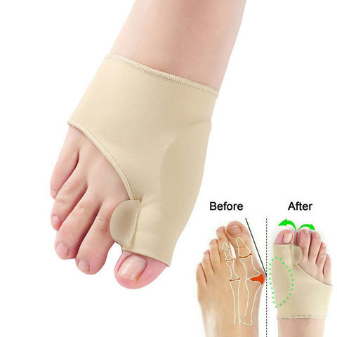 Corrector ortopédico de juanete, 1 par, calcetines de silicona para pedicura, Corrector de Hallux Valgus, separadores de dedos, herramienta de cuidado de los pies ► Foto 1/6