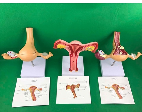 Modelo de dissección de ovario y uterino, patología femenina, modelo de enseñanza de células uterinas, ayuda médica, anatomía del útero ► Foto 1/6