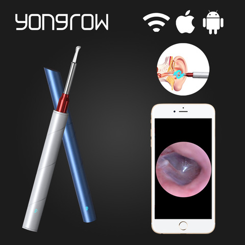 Yongrow médico HD Cámara Visual otoscopio oído limpiador cera Wifi Android inalámbrico IOS oído pick boroscopio HERRAMIENTA DE CUIDADO DE OÍDO Earpick ► Foto 1/6