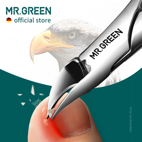 MR.GREEN-cortauñas para uñas, uñas encarnadas cortauñas para, herramientas de pedicura antisalpicaduras Olecran Podiatry paroniquia, herramienta de manicura de corrección ► Foto 1/6