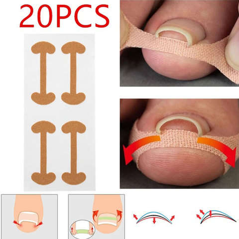 20 piezas-Corrector de uñas para el cuidado de las uñas, pegatina profesional para el cuidado de las uñas de los pies, pedicura, curvatura de pulgar ► Foto 1/6