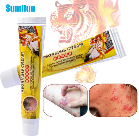 Sumifun 1 Uds bálsamo de tigre problema de la piel tratamiento Psoriasis Eczema Dermatitis pomada a base de hierbas crema antibacteriana picazón de yeso ► Foto 1/6