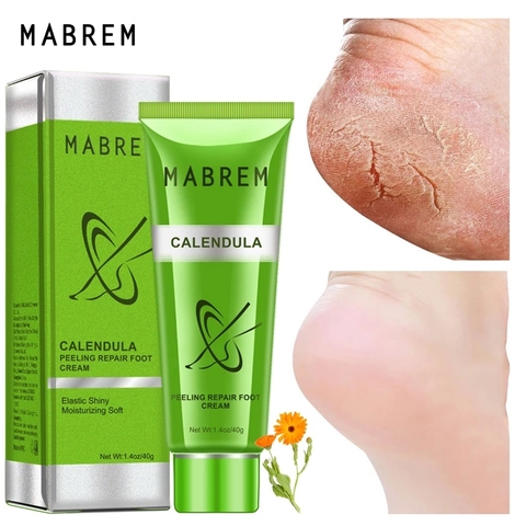 Masbem-Crema para el tratamiento de los pies, crema blanqueadora, antigrietas, hidratante, exfoliante para el cuidado de los pies, reparador de Olivo de caléndula antiseco, 40g ► Foto 1/6