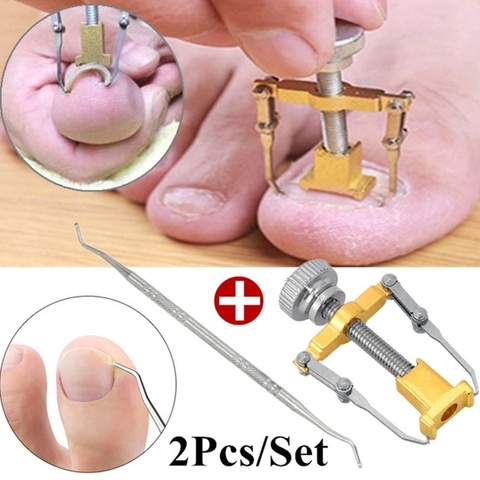 Ingrown-Dedo del pie de pedicura para el cuidado de las uñas, herramienta de limado, parche elástico, alisado, Clip corrector ortopédico, fijador de alambre ► Foto 1/6