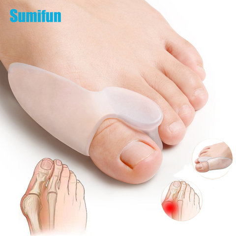 Sumifun 2 uds de silicona separador de dedos para juanete hueso Ectropion ajustador de pulgar exterior de pie, herramientas para el cuidado de Corrector de Hallux Valgus ► Foto 1/6